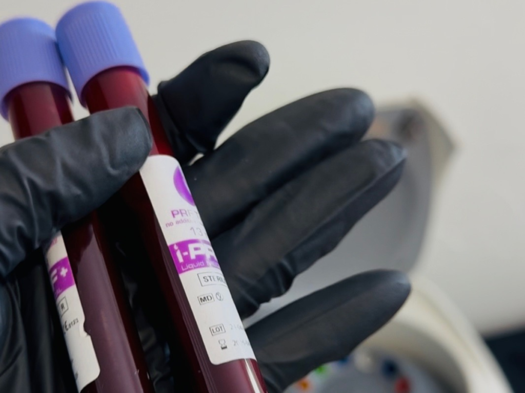 nurse holding two collection tubes of blood
